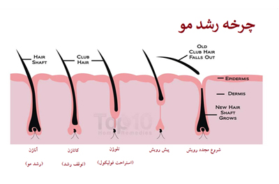 در این جا به بررسی وضعیت چرخه مو می پردازیم . در این جا به بررسی وضعیت چرخه مو می پردازیم .