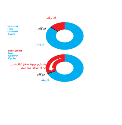 اختلالات شایع چرخه رشد مو اختلالات شایع چرخه رشد مو